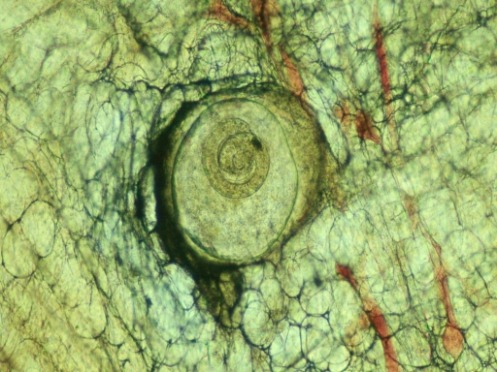 Mikroskopisch vergrössertes Bild von Trichinen.