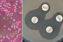 Antibiotikaresistente Keime auf Agarplatte mit Hemmhöfen